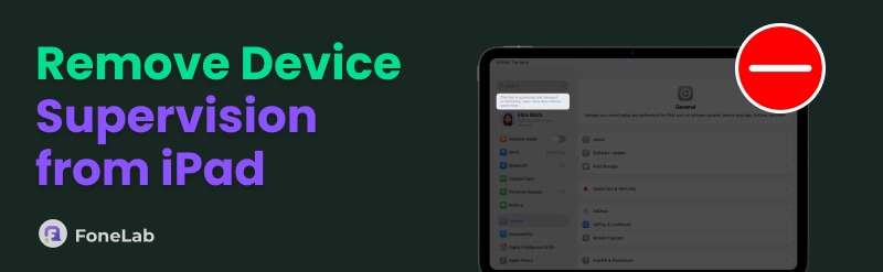 How to Remove Device Supervision from iPad