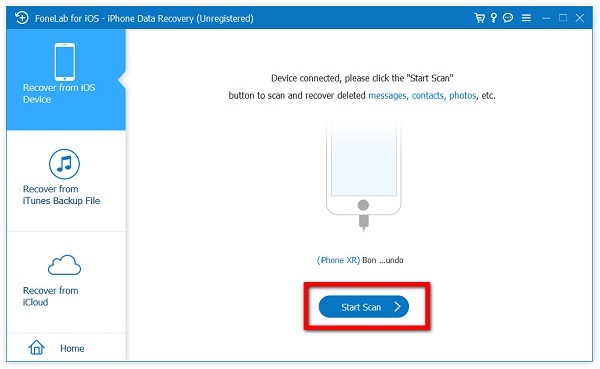 click the Start Scan button