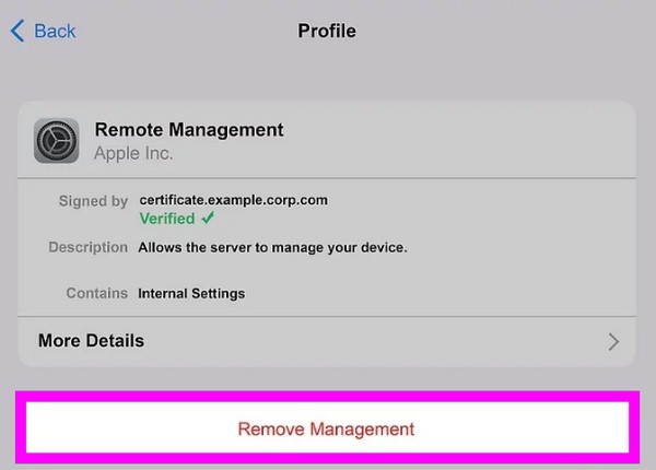 remove remote management on settings
