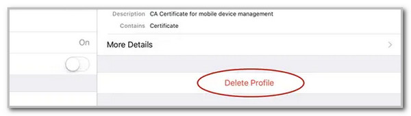 tap delete profile button