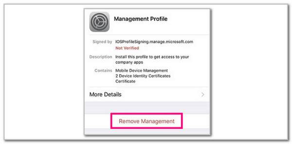 tap remove management