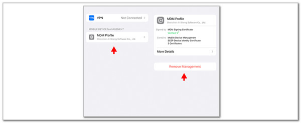 choose remove management