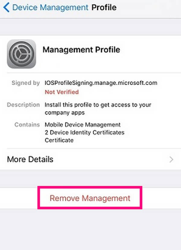 remove mdm on settings app