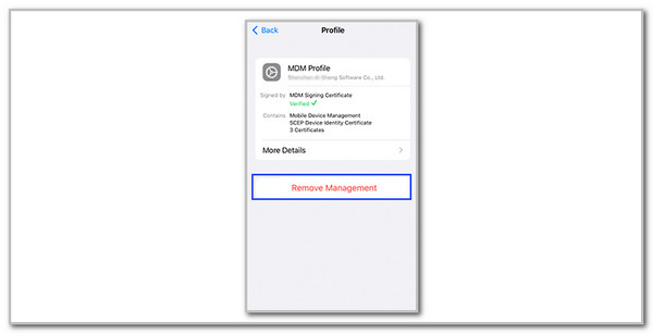 tap remove management