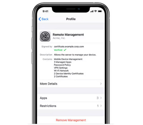 Tap Remove Management Button