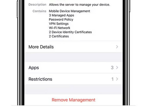 Tap Remove Management Button